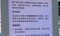 博主坦言美国看病太贵太麻烦：想把中国的AI医生带回去