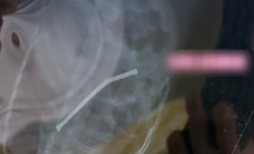 
        		3岁娃吞下40多颗磁力珠致胃穿孔 奶奶以为能自行排出 !	